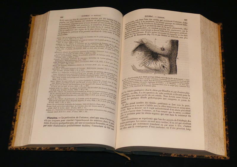 Nouveau dictionnaire de médecine et de chirurgie pratiques illustré de figures intercalées dans le texte (40 volumes)