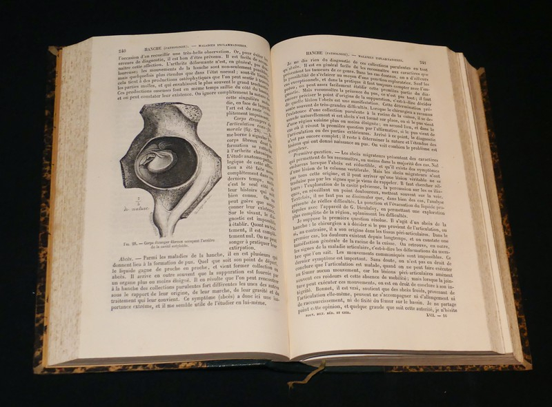 Nouveau dictionnaire de médecine et de chirurgie pratiques illustré de figures intercalées dans le texte (40 volumes)