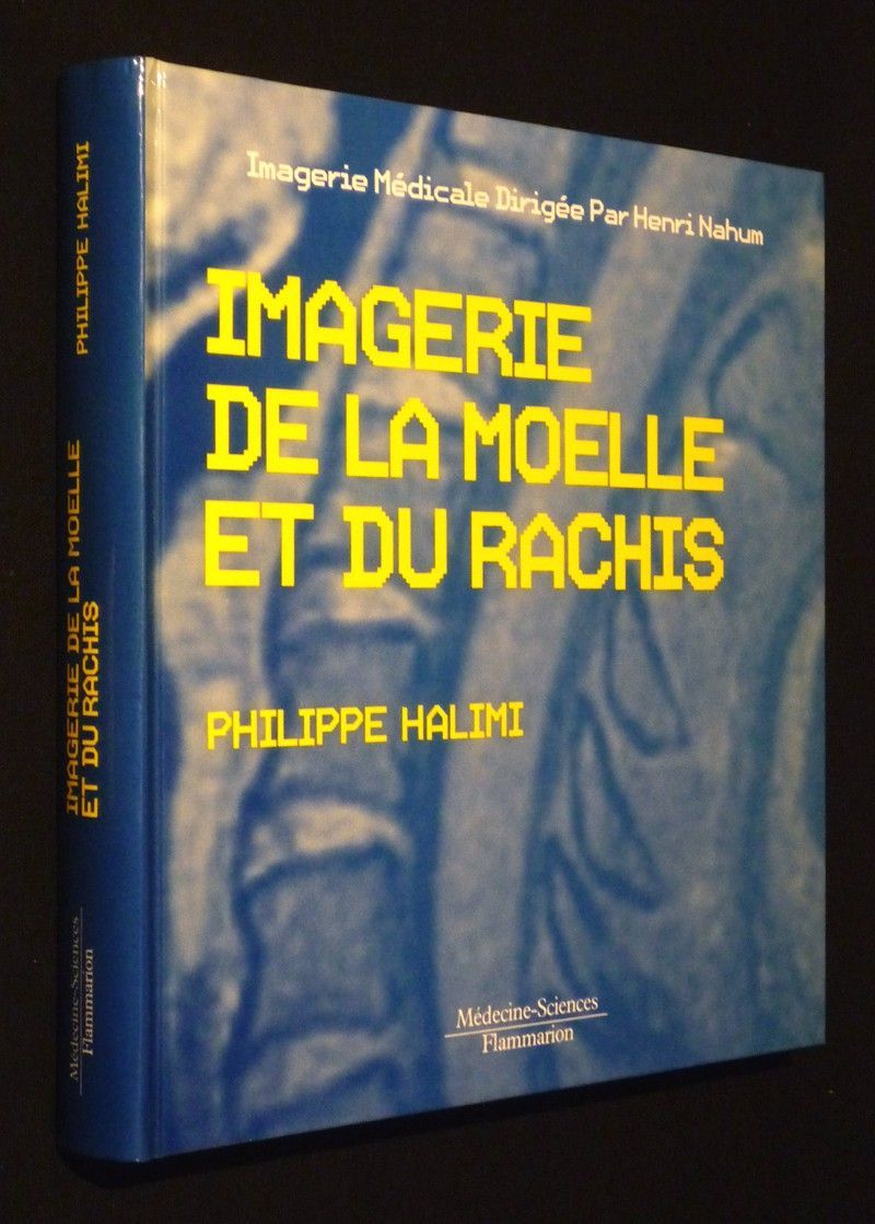 Imagerie de la moëlle et du rachis
