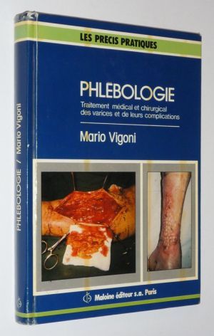 Phlébologie : traitement médical et chirurgical des varices et de leurs complications