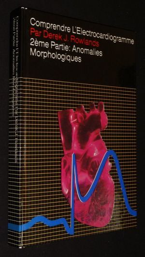 Comprendre l'électrocardiogramme