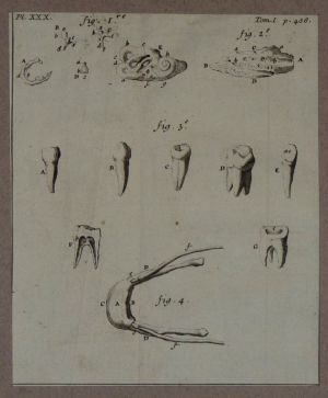 Gravure tirée de "L'Anatomie chirurgicale" de Palfin (1734) : Tome 1, planche XXX