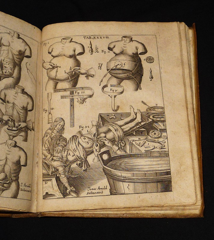 Wund-Artzneyisches Zeug-Hauß. In Zween Theil abgetheilt : Welches auß dem Lateinischen von dess Authoris Brudern Sohn Herrn Johann Schultes, reformirtem, verbessert, und an vilen Orten vermehrtem, auch mit 56 neuen, sehr nutzlichen Kupfferstücken gezierte