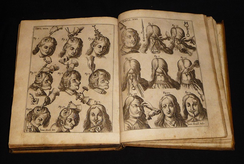 Wund-Artzneyisches Zeug-Hauß. In Zween Theil abgetheilt : Welches auß dem Lateinischen von dess Authoris Brudern Sohn Herrn Johann Schultes, reformirtem, verbessert, und an vilen Orten vermehrtem, auch mit 56 neuen, sehr nutzlichen Kupfferstücken gezierte